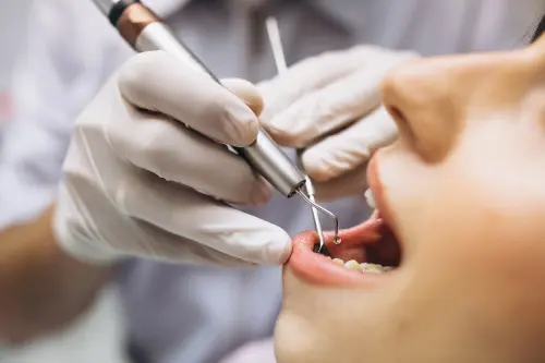 Come scegliere il dentista? Soluzioni e consigli utili